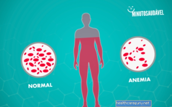 Hvordan vite om det er anemi: symptomer og diagnose