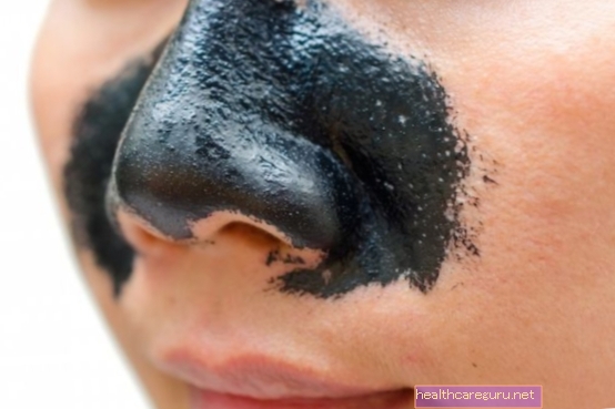 5 стъпки за премахване на черни точки от носа