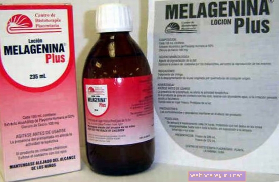 Melagenin Plus untuk Vitiligo