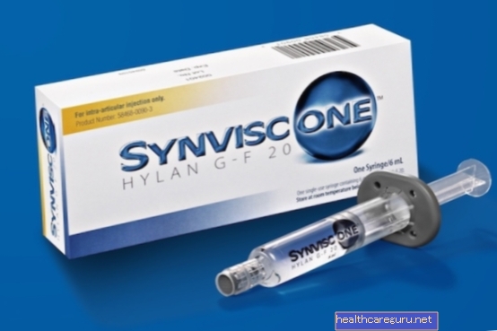 Synvisc - Infiltracija za zglobove