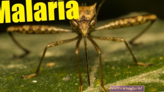 8 prvih simptomov malarije