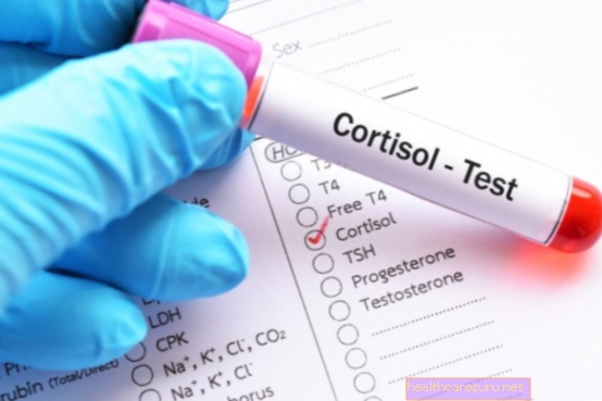 Visok kortizol: kaj lahko je, simptomi in kako prenesti
