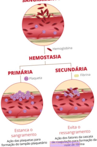 Čo je primárna a sekundárna hemostáza a ako zistiť, či je zmenená