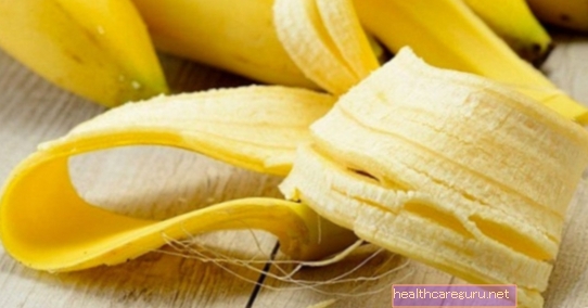 8 galvenās banānu mizas priekšrocības un lietošanas veids