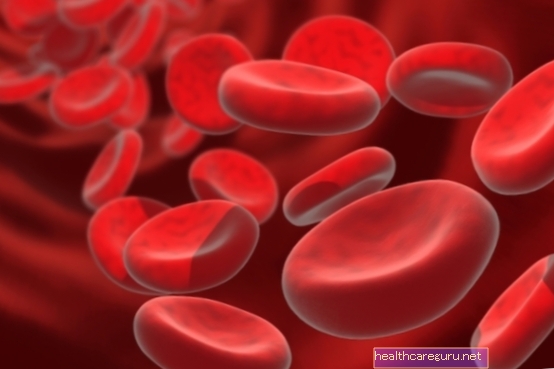 Хемолитичка анемија: шта је то, главни симптоми и лечење