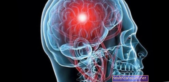 النزف الدماغي: الأعراض والأسباب والعواقب المحتملة