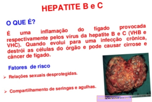 Kronični hepatitis: kaj je to, simptomi, vzroki in zdravljenje