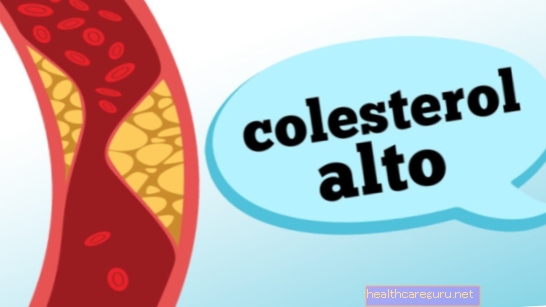 Korkea kolesteroli - mitä syödä ja mitä välttää