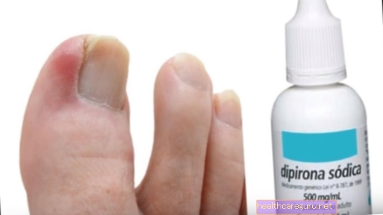 Как да се лекува трихофития на кожата и ноктите