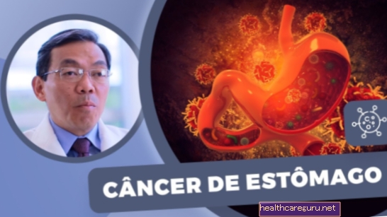 Kas ir bazālo šūnu karcinoma, galvenie simptomi un ārstēšana
