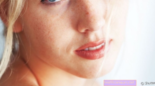 Τι είναι το λευκό πανί στο δέρμα, οι θεραπείες και πώς να αντιμετωπιστεί