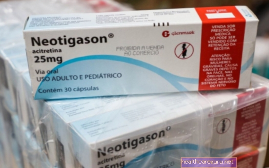 Retsmidler mod psoriasis: salver og piller