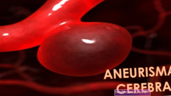 Cerebrale aneurysma: wat het is, symptomen, oorzaken en behandeling