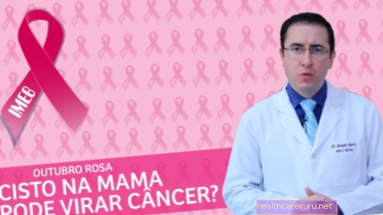 Može li se cista dojke pretvoriti u rak?