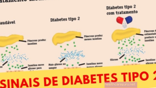 2. tüüpi diabeet: sümptomid, testid ja ravi