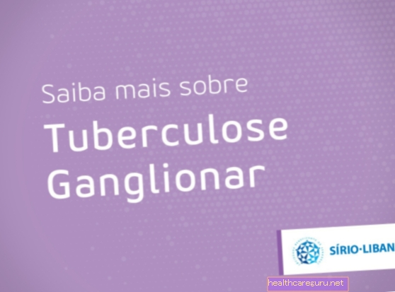 Come identificare la tubercolosi ganglionare e come trattarla