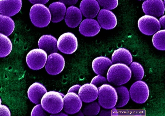 Stafylokoky (Staphylococcus): aké sú, hlavné druhy a príznaky