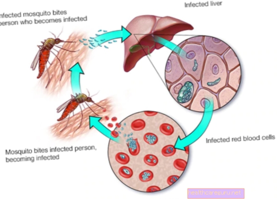 Malaria: mikä se on, sykli, tartunta ja hoito