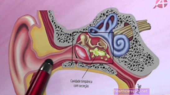 耳炎メディア：それが何であるか、主な症状と治療