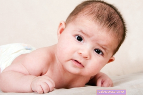 Hvordan behandle medfødt tortikollis hos baby