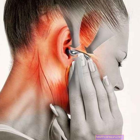 Temporomandibulaarinen häiriö (TMD): mikä se on, oireet ja miten hoitaa