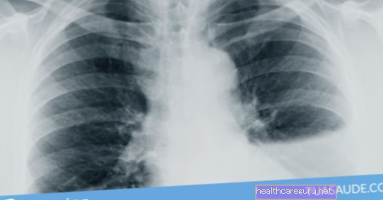 5 penyebab utama air di paru-paru