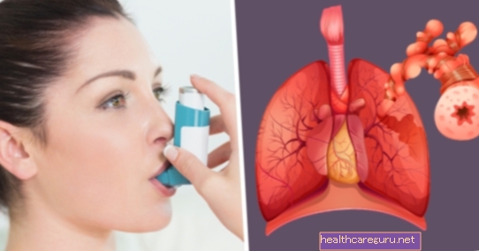 Astmatisk bronkitt: hva det er, symptomer og behandling