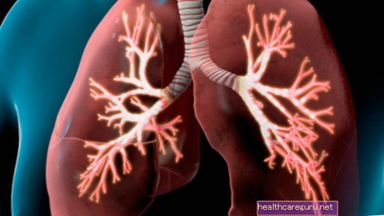 Kako prepoznati pljučni emfizem, preprečevanje in zdravljenje