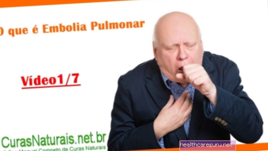 Pljučna embolija: kaj je to, glavni simptomi in vzroki
