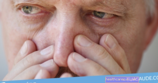 Спаљивање носа: 6 главних узрока и шта треба учинити
