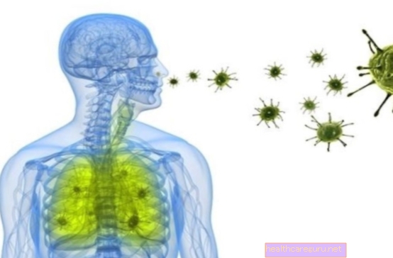 Pneumonia bakteria: gejala, penularan dan rawatan