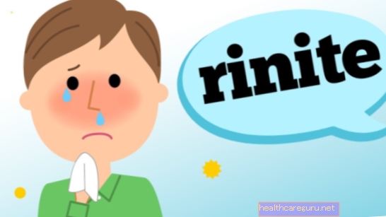 Rhinitis: Was es ist, Hauptsymptome und Behandlung