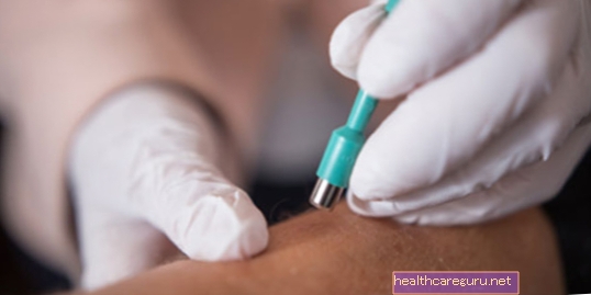Biopsija kože: kako se radi i kada je naznačena