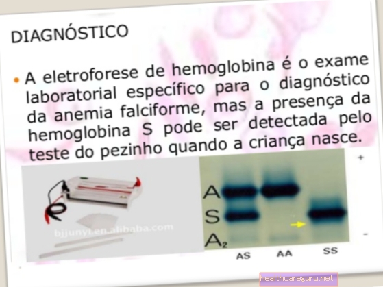 Elektroforesis hemoglobin: apa itu, bagaimana ia dibuat dan untuk apa