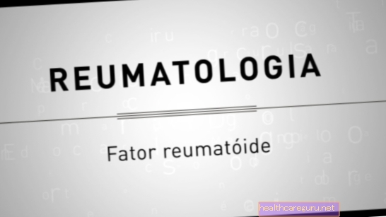 Revmatoid faktor: hva det er, hvordan det gjøres og hvordan man skal forstå resultatet