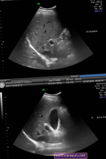 Ultrasound perut total: apa itu, apa itu dan bagaimana menyediakannya