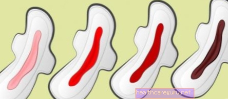 Donkere menstruatie: 6 oorzaken en wanneer u zich zorgen moet maken