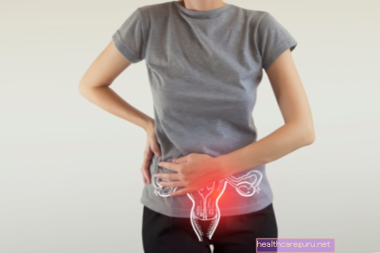 Retrogradna menstruacija: kaj je, simptomi in zdravljenje