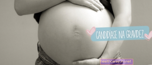 Καντιντίαση κατά την εγκυμοσύνη: συμπτώματα και επιλογές θεραπείας