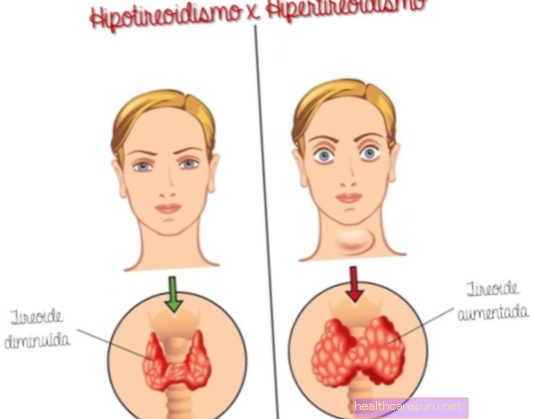 Hipotiroidizem v nosečnosti: tveganja, kako prepoznati in kako je zdravljenje