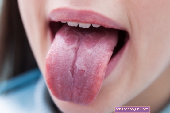 Vlekjes op de tong: wat kan zijn en wat te doen