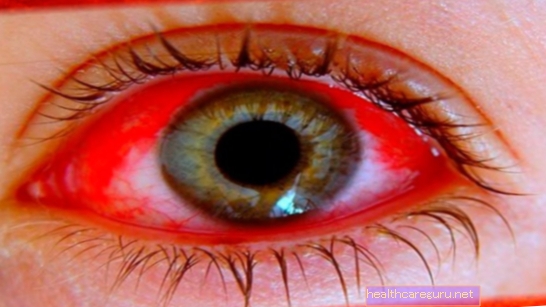 Symptomen van zichtproblemen