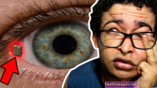 Kako odstraniti madež iz očesa