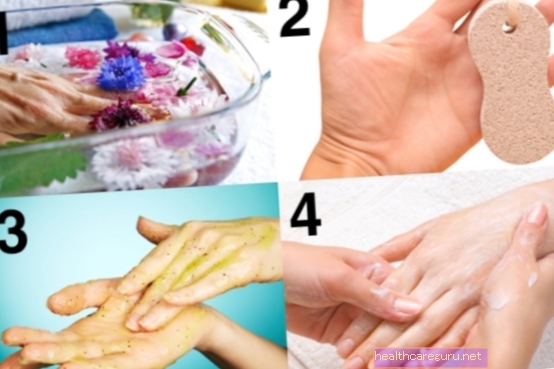 4 kroky na odstránenie mozoľov z vašich rúk