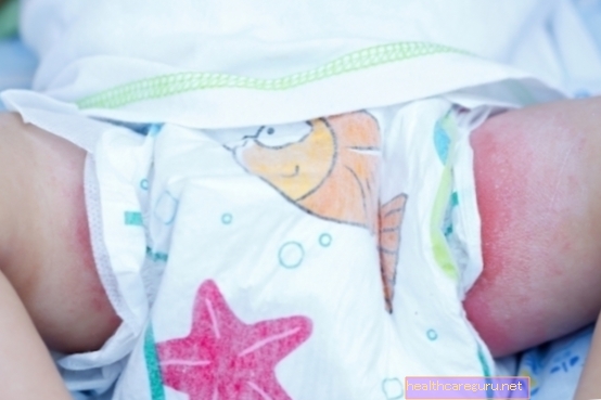 Crvene mrlje na bebi: što može biti i kako liječiti