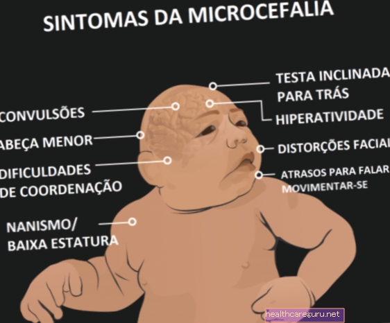 Mikrocefalija: što je to, simptomi, uzroci i liječenje