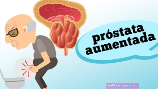 Prostata: hva det er, hvor det er, hva det er for (og annen tvil)