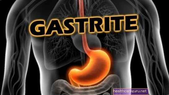 6 peamist gastriidi sümptomit