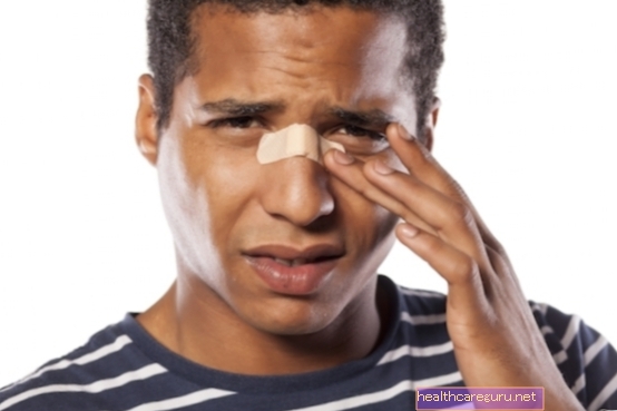 8 ninaverejooksu põhjust ja kuidas ravida