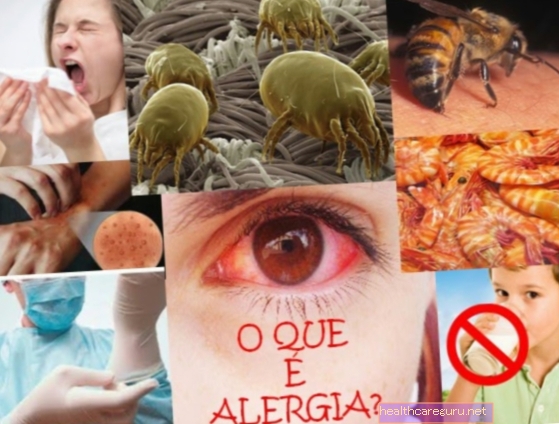 Kaj je alergija na hrano, simptomi, glavni vzroki in zdravljenje
